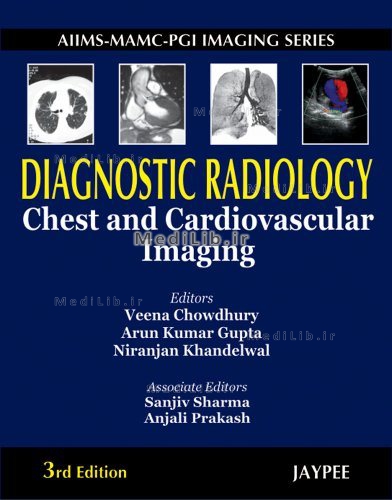 AIIMS-MAMC-PGI Imaging Series Diagnostic Radiology Chest and Cardiovascular Imaging