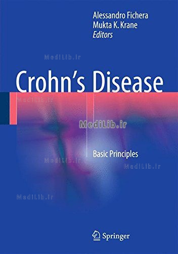 Crohn’s Disease