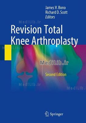 Revision Total Knee Arthroplasty (2nd 2018 edition)