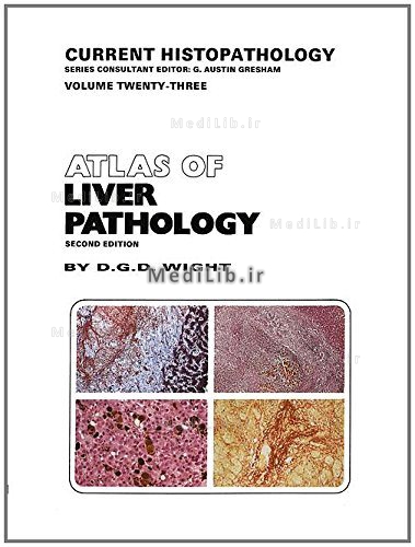 Atlas of Serous Fluid Cytopathology